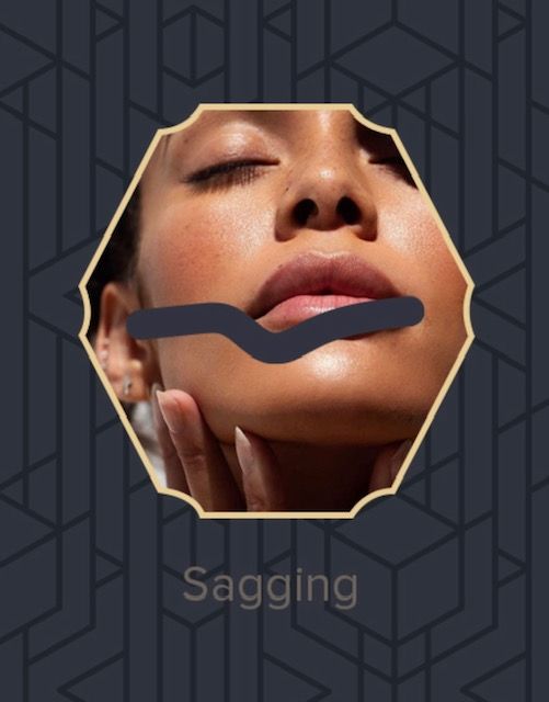 Beauty IQ Pro Spa Skincare Sagging | Ask The Esthetician